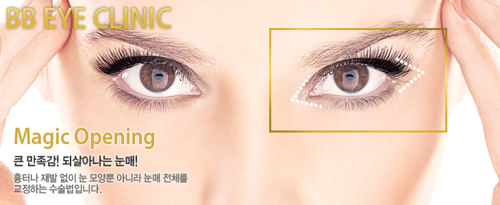 BB Eye Clinic Magic Opening ū ! ǻƳ ! ͳ     ƴ϶  ü ϴ Դϴ.