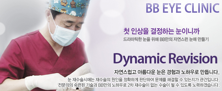BB Eye Clinic ù λ ϴ ̴ϱ ƽ   BB ڿ   Dynamic Revisionڿ Ƹٿ   Ͽ ϴ. ÿ   Ȯϰ ǴϿ  ذ  ִ Դϴ.  õ  BB Ͽ 2      ֵ ϰڽϴ.